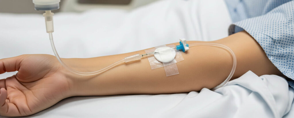 IV Treatments