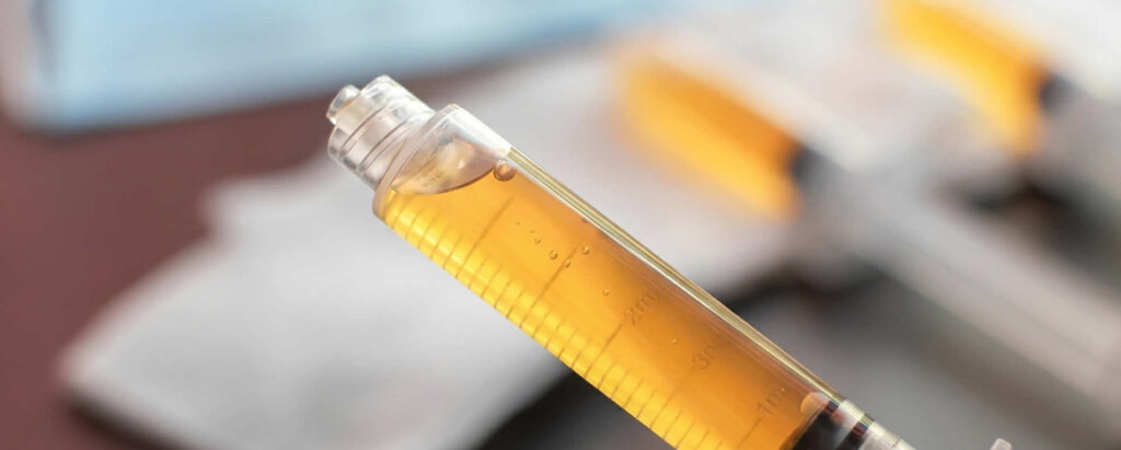Platelet-Rich Plasma (PRP)